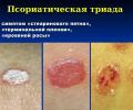 Факторы риска заболевания себорейного дерматита и псориаза - доктор