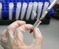 Мальчик из Таджикистана заразил шестерых детей в Иркутской области вирусом гепатита