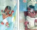 Китаянка родила дочурок-близняшек спустя шесть суток после рождения сына