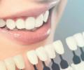 Какие факторы влияют на цвет зубов