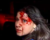 Во время репортажа о смерти Уго Чавеса журналистке разбили голову