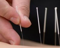 В Китае 4-летняя россиянка впала в кому после курса иглотерапии