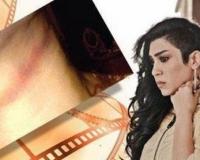 Актриса едва не погибла во время съёмок смертной казни для популярного сериала