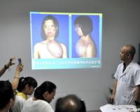 Китайским медикам удалось возобновить прежний облик девушки, сильно пострадавшей в результате пожара