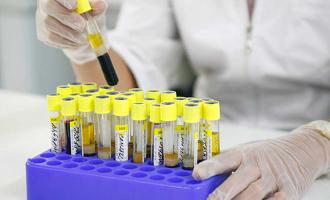 Ученые из Новосибирска разработали метод сверхраннего выявления рака