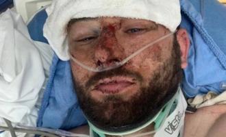 О западно-лотианском кругосветном велосипедисте, пострадавшем в результате крушения США